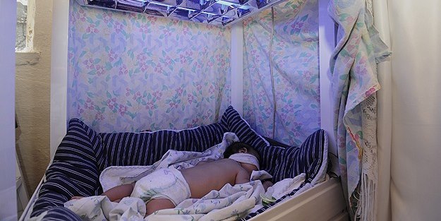 'Mavi Işık' hastası bebek tedaviye alındı