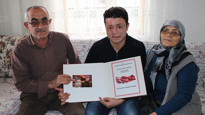 Mayın yüzünü parçalasa da, gülümsemesi hala yüzünde