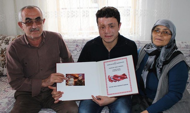 Mayın yüzünü parçalasa da, gülümsemeye devam!