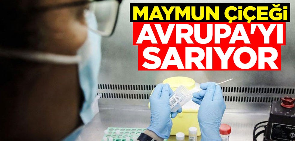 Maymun çiçeği Avrupa'yı sarıyor