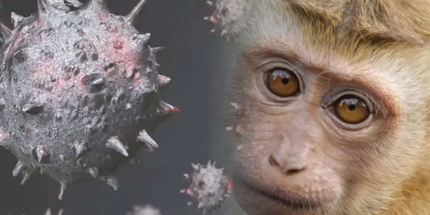 Maymun çiçeği virüsü o ülkeye de sıçradı!