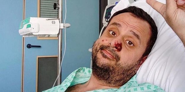 Maymun çiçeğine yakalanan Türk vatandaşı yaşadıklarını anlattı