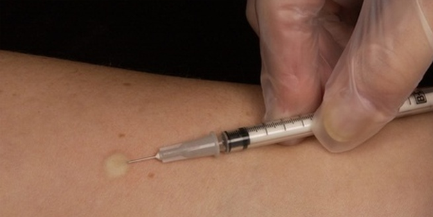 Maymun çiçeğinin merkez üssü Kongo'da aşılama başlayacak