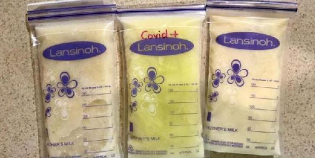 Koronavirüse yakalanan annenin sütü yeşil renge döndü