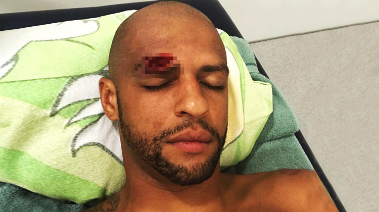 Melo yürekleri ağza getirdi! İşte son hali