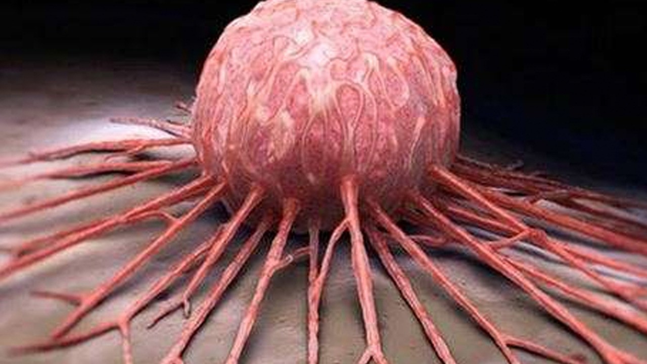 Meme kanseri teşhisi ‘Hayati önem taşıyor! Tedbiri alın: Siz kontrol ettirdiniz mi?