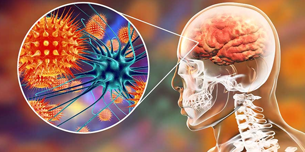 Menenjit salgını 65 kişiyi öldürdü!