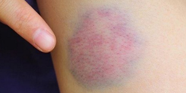 Mentollü kremi tuz ile karıştırırsanız...