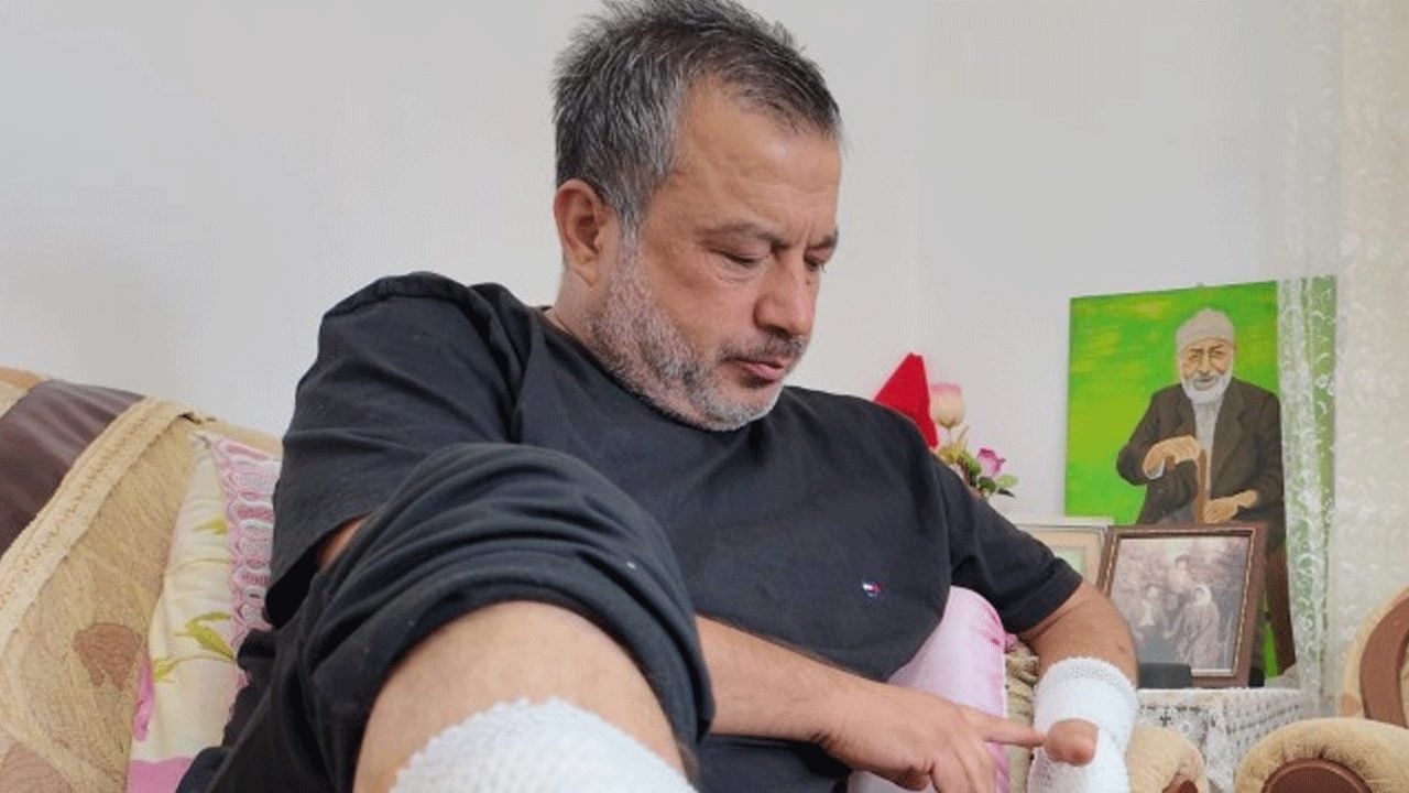 Mersin'de sahipli köpek hastanelik etti!