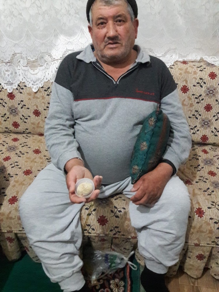 Mesanesinden 300 gram ağırlığında taş çıktı 