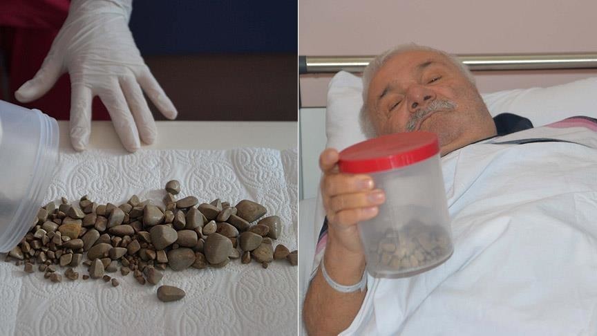 Mesanesi taş doluymuş!