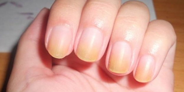 Mevsim geçişlerinde tırnak bakımı