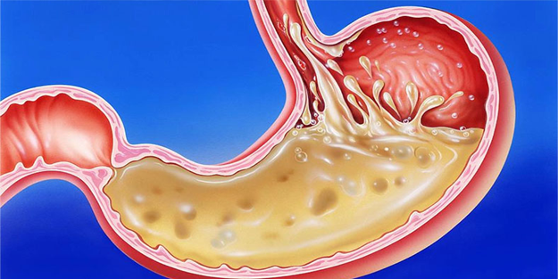 Mide asidi midemizdeki her şeyi eritirken nasıl oluyor da midemizi de eritmiyor?