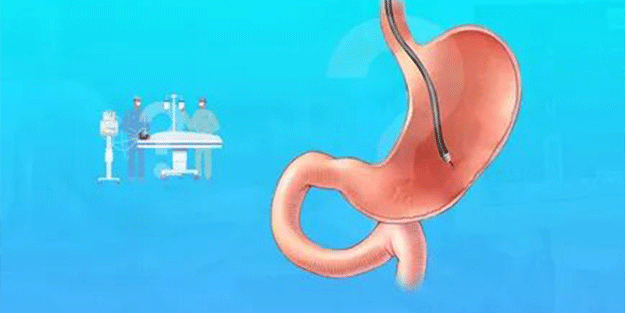 Mide botoksu yaptıranlar dikkat! Ölü sayısı hızla artıyor