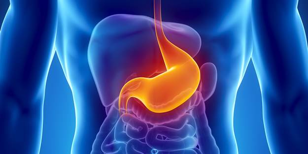 Mide yanması neden olur?