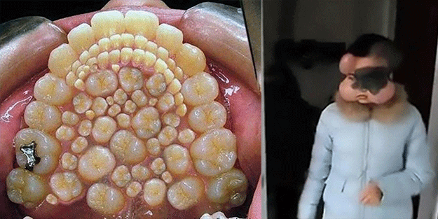 İşte Dünyanın en garip hastalıkları