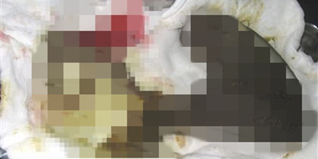 Midesinden bakın ne çıktı!