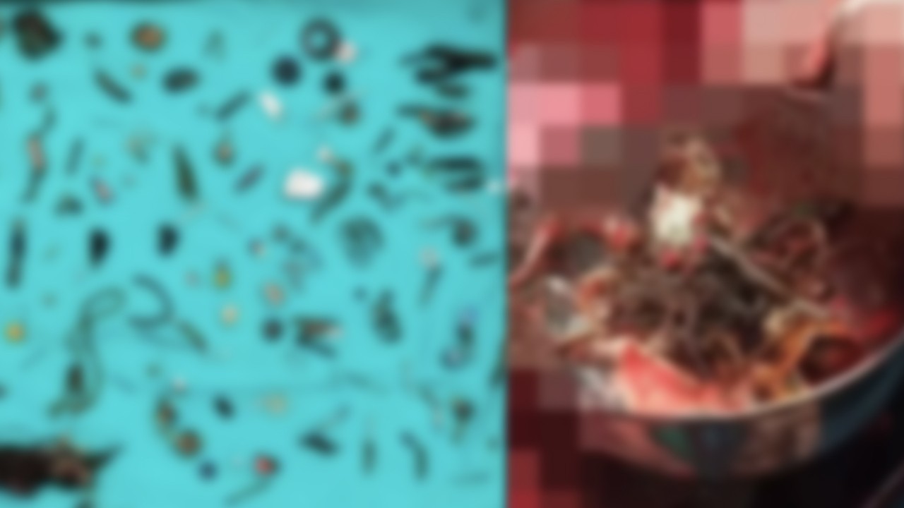 Midesinden çıkanlarla sergi açılır! Öyle şeyler çıktı ki doktorlar bile şaştı kaldı