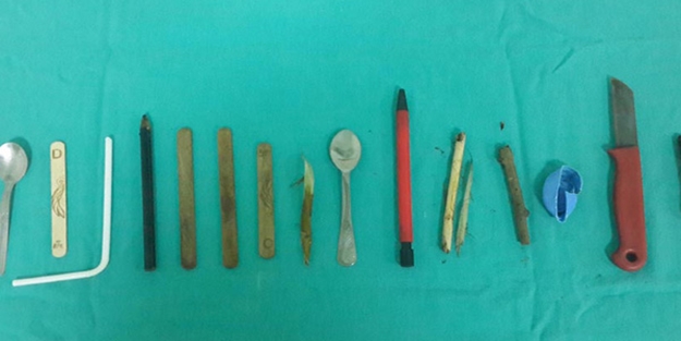 Midesinden bakın neler neler çıktı!