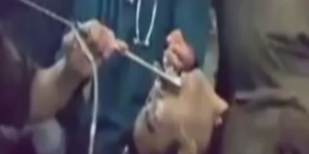 Midesinden öyle bir şey çıktı... Görenleri hayrete düştü