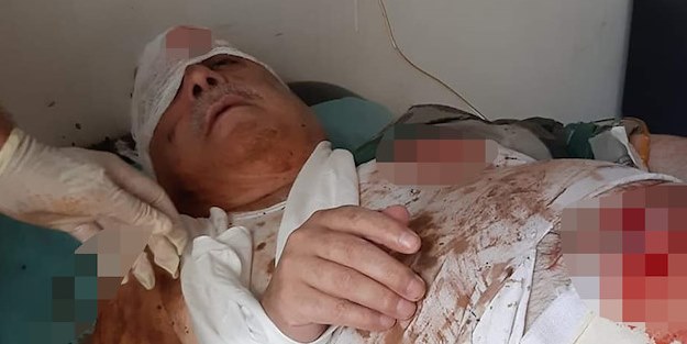 Mihraç Ural'a bombalı saldırı! Ağır yaralandı