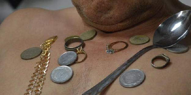 ‘Mıknatıs adam’ı gören şaşırıyor