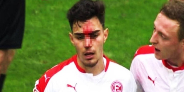 Milli oyuncu kanlar içinde kaldı!