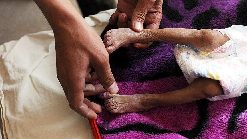 'Milyonlarca Yemenli aç uyuyor'