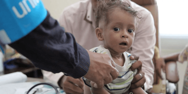 'Milyonlarca Yemenli açlığa sürükleniyor!'