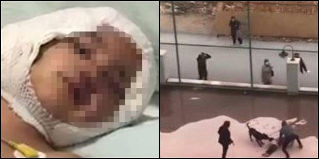 Minik Asiye'den kötü haber! 'İtçiler'in sokakları terörize etmesinin ardından bir çocuğun daha hayatı karardı!