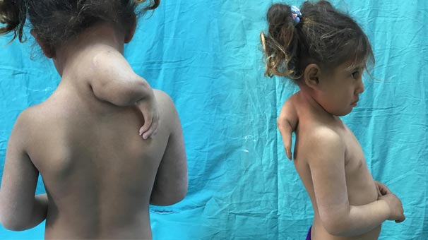 Minik Hülya'nın 3'üncü kolu alındı!