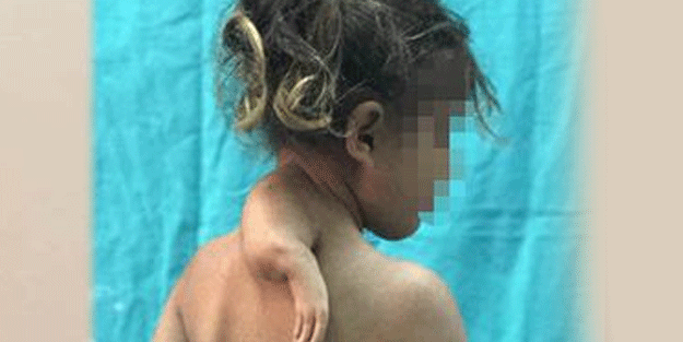 Görenler şaşkına döndü! Ensesinde 3. kolu....