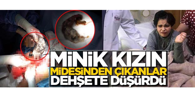Minik kızın midesinden çıkanlar dehşete düşürdü!