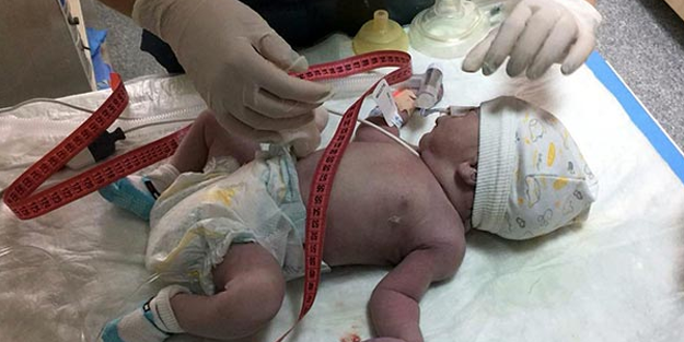 Minik Ömer sadece 17 gün yaşayabildi