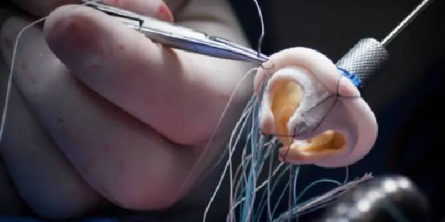 'Minimal invaziv cerrahisi açık kalp ameliyatına göre daha avantajlı