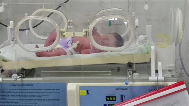 Miray bebeğin şüpheli ölümü