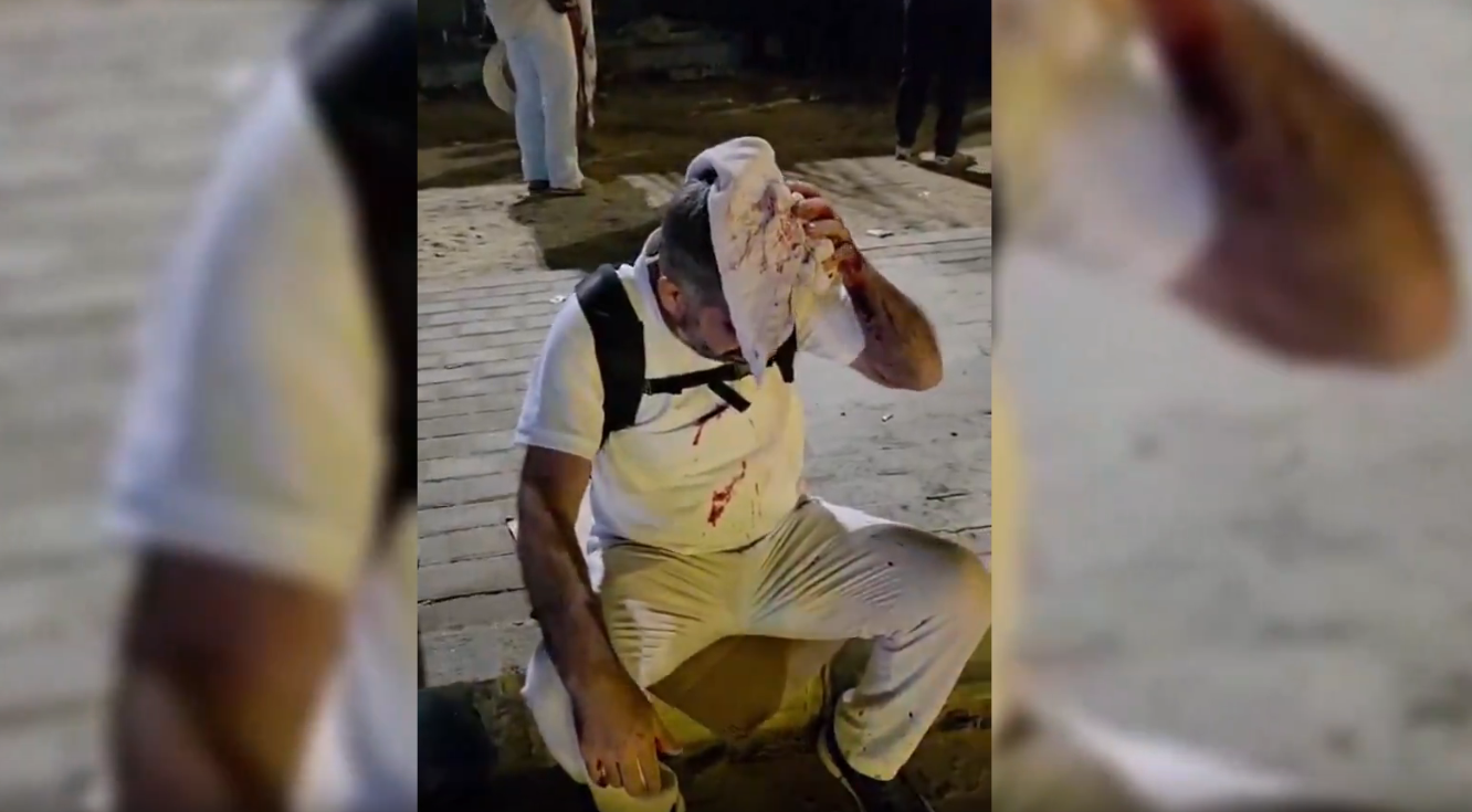 Mısır’da HÜDA Par Milletvekili Faruk Dinç’e saldırı: Feci şekilde yaralandı