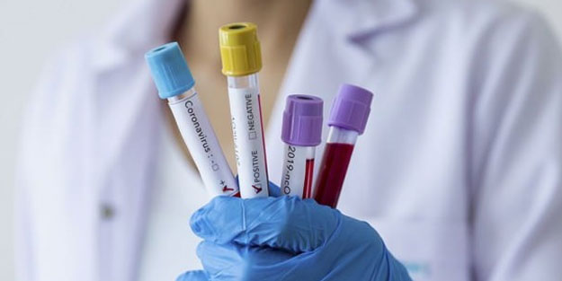 Mısır'da koronavirüs vaka sayısı tırmanıyor