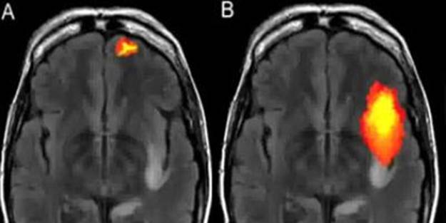 mRNA aşısının nasıl bir bağlantısı var? CIA'in gizli toplantısı sızdırıldı! Çarpıcı "tanrı geni" açıklaması