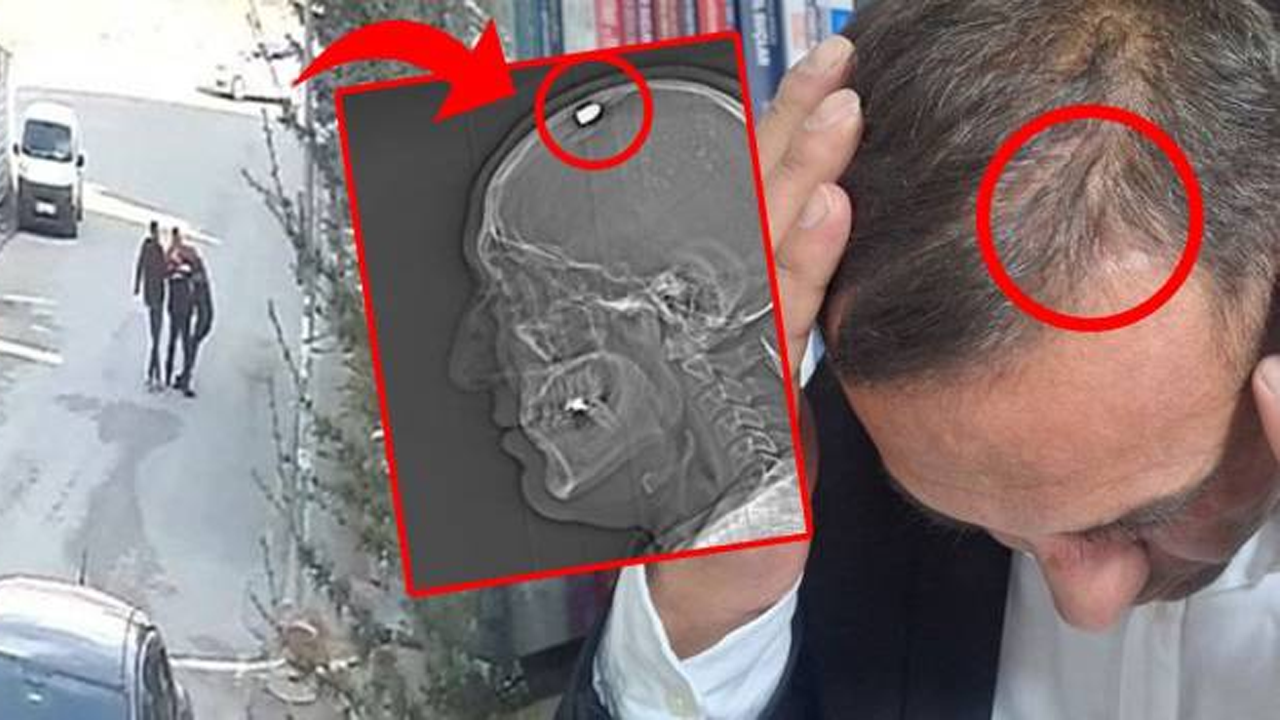 Mucize kurtuluş! Başından vurulan kurye o anı anlattı: 'Ölü taklidi yaptım'