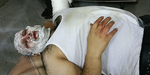 Muhabir, Esed güçlerinin füzesiyle yaralandı