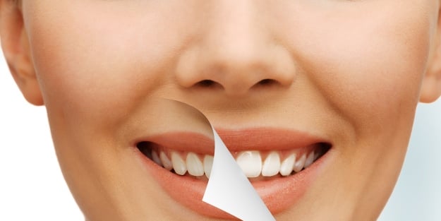 Mükkemmel gülüş ve bembeyaz dişlere sahip olmak için 8 ipucu