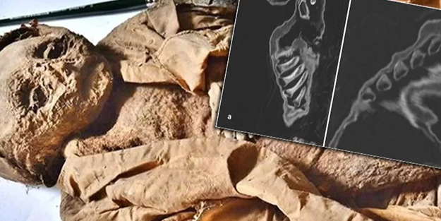 Avusturya'da bulunmuştu! Mumya bebek 400 yıl önce mumyalanmış! Ölüm nedeni belirlendi