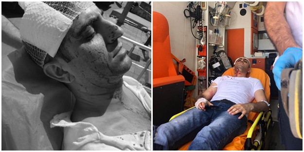 Murat Alan’a saldıran ülkücü, asker kaçağı çıktı!