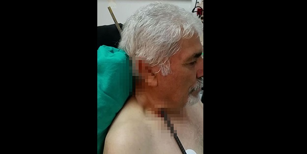 Sivas'ta müteahhitin boynuna 6 metrelik demir saplandı