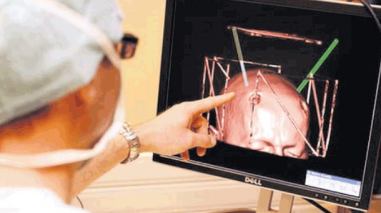 Müthiş haber! Bilim insanları beyin üretti