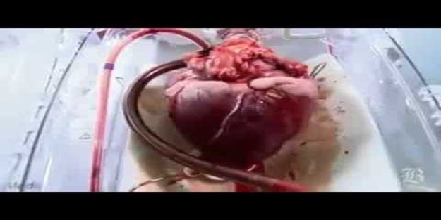 Nakil için çarpan bir kalbin taşınması!