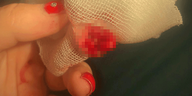 Nasıl olduğunu anlamadı bile! Yemek yemek için gittiği köftecide parmağı koptu