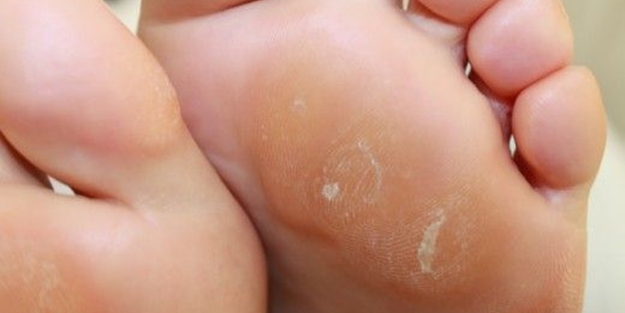 Nasır bir günde nasıl geçer? İşte cevabı