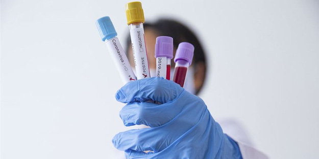 Ne Çin ne ABD ne de Rusya! Koronavirüsü dünyaya yayan ülke ortaya çıktı